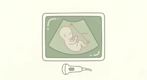 dépistage trisomie 21 grossesse